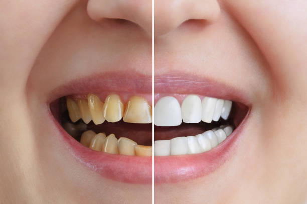 Cosmetic Dentistry Treatments Guide: Types, Benefits, and What to Expect