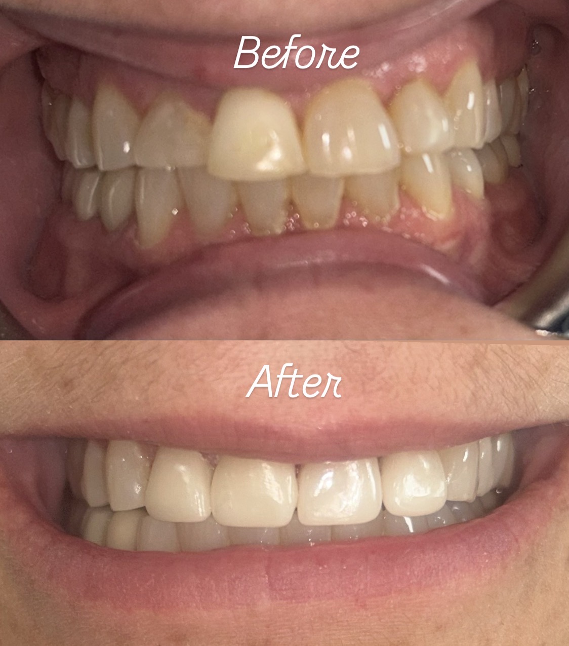 bennett family dental before and after