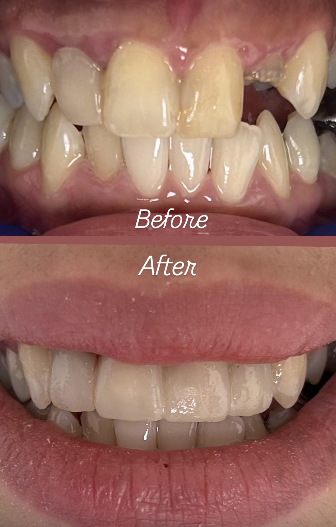 bennett family dental before and after