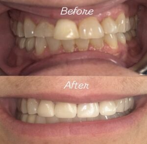 9 Common Oral Health Myths That Could Be Hurting Your Smile