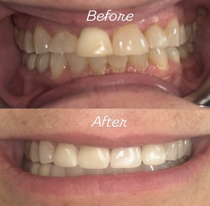 9 Common Oral Health Myths That Could Be Hurting Your Smile