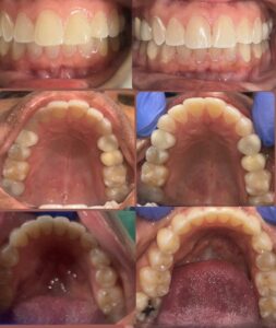 Are Dental X-Rays Safe? Everything Patients Should Know Before Their Visit