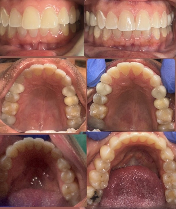 Are Dental X-Rays Safe? Everything Patients Should Know Before Their Visit